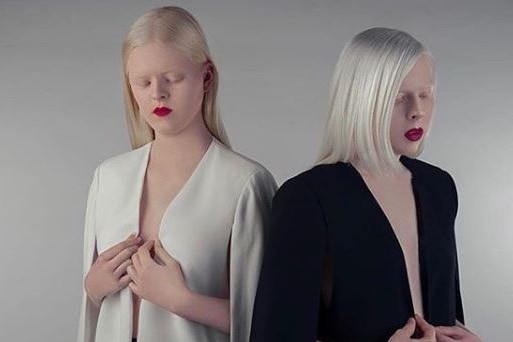 Two blond women with albinism stand side by side