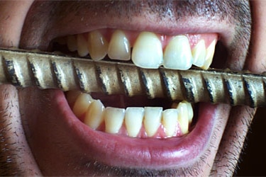 Teeth biting metal
