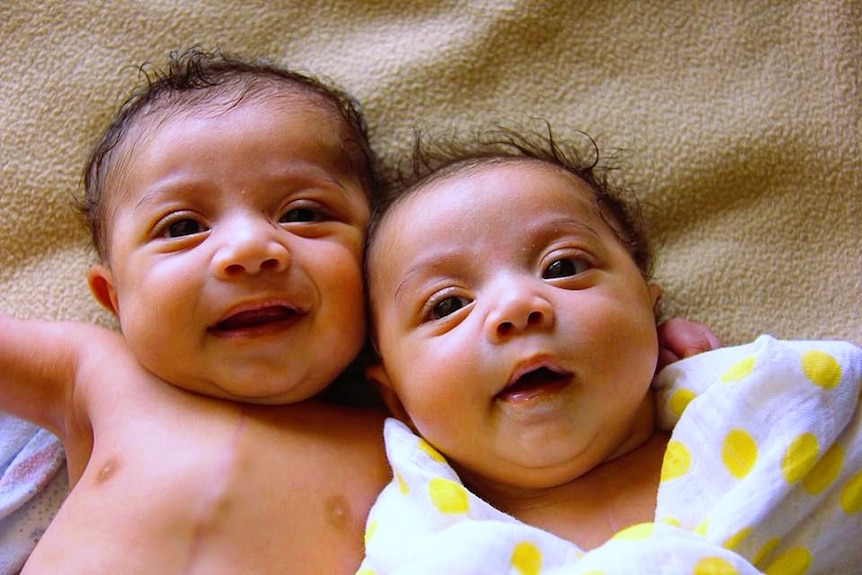 Two babies lying down.  One has a visible scar on his chest while the other is wrapped in a blanket.