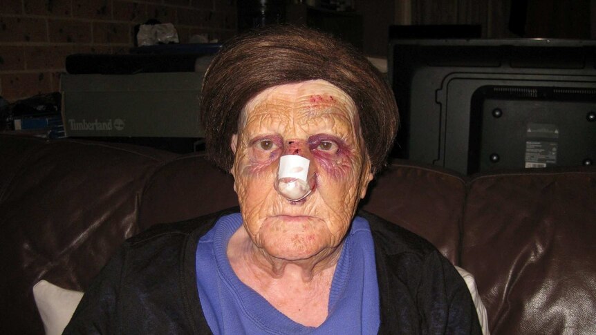 Elderly woman Lorette Doueihi suffered extensive bruising to her face during an attempted robbery.