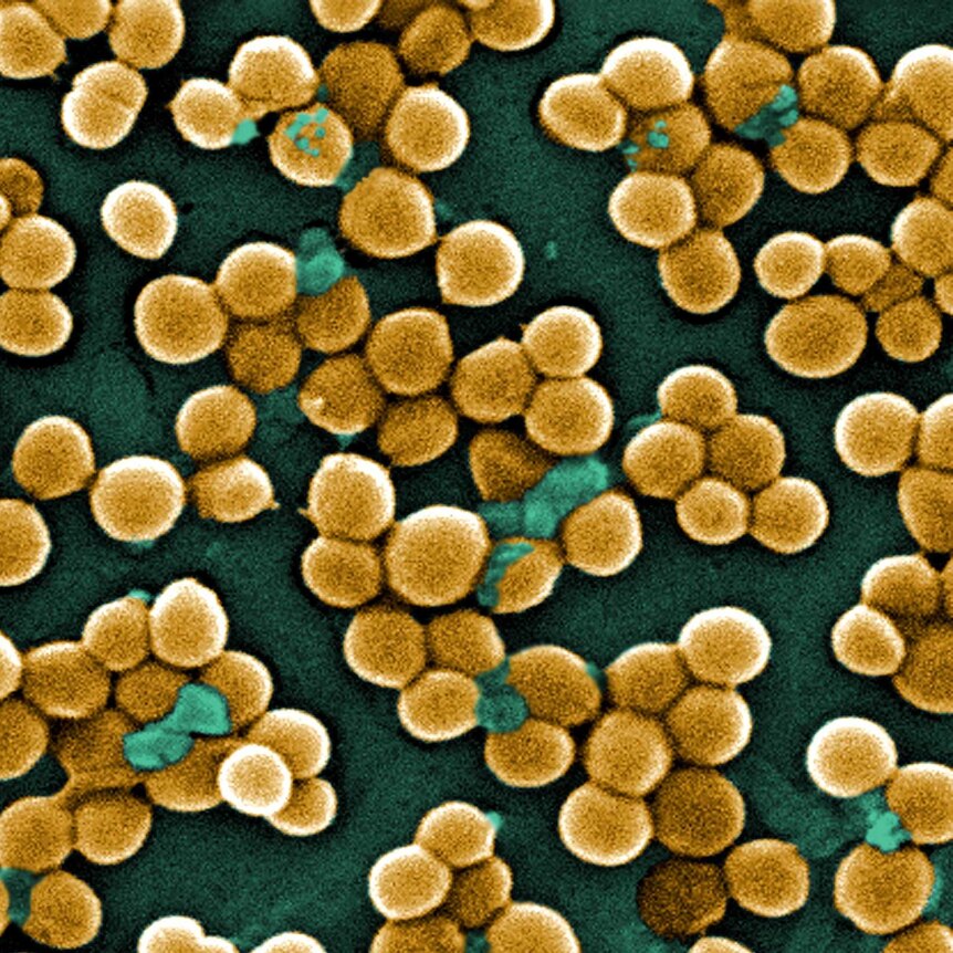 MRSA (Methicillin-resistant Staphylococcus aureus) under an electron scanning microscope