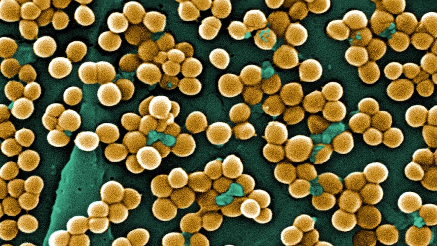 MRSA (Methicillin-resistant Staphylococcus aureus) under an electron scanning microscope