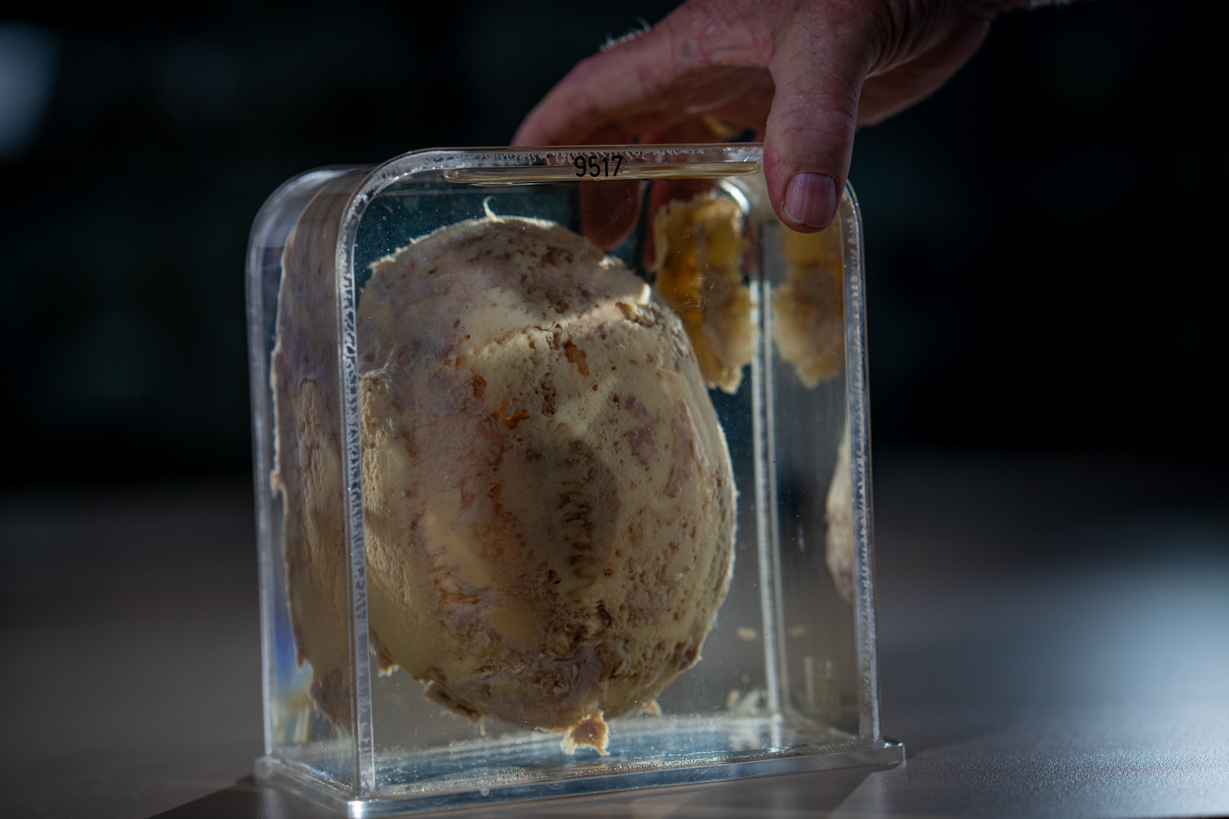 A man holding a resin block, encased inside is a damaged skull with small holes.