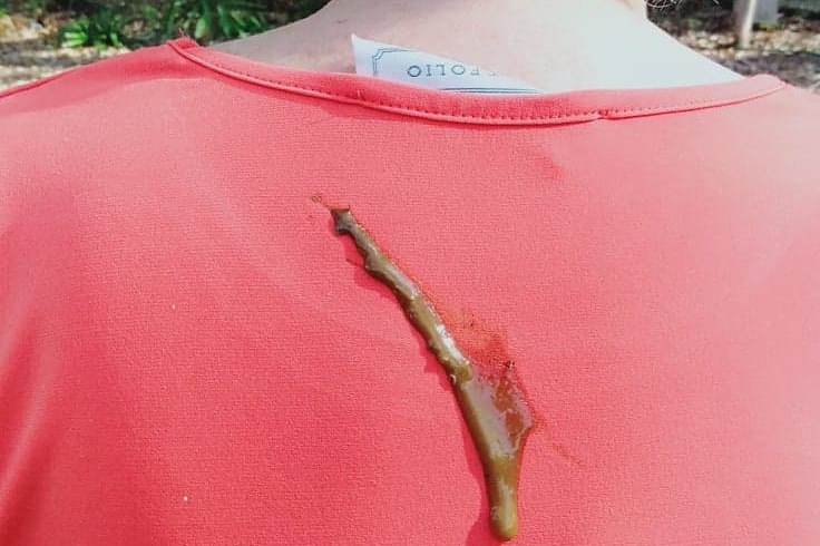 The flying fox poo on the back of a woman's shirt.