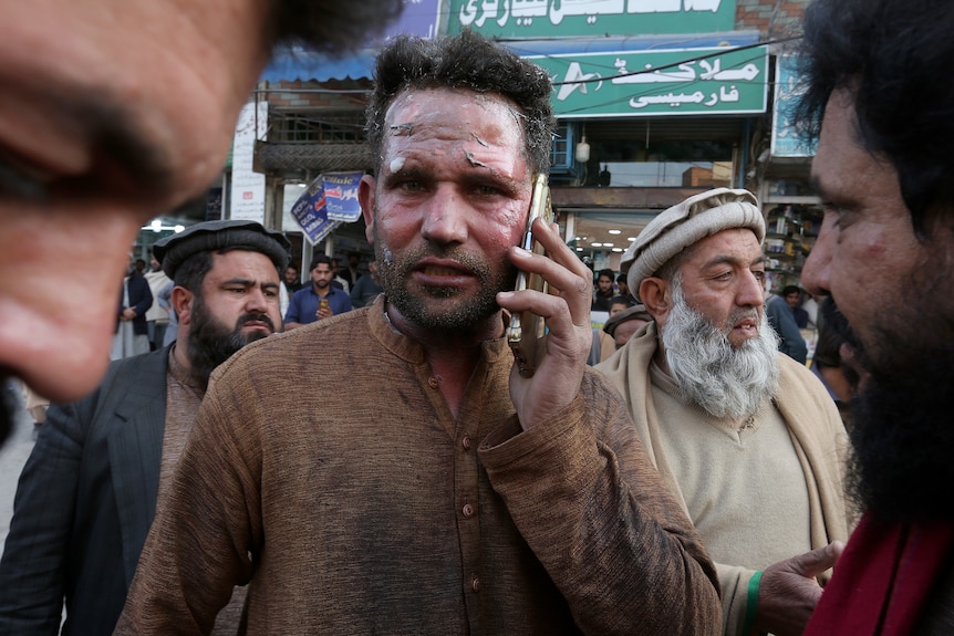 A man covered in sweat and dust uses a mobile phone as he is surrounded by a crowd of men.