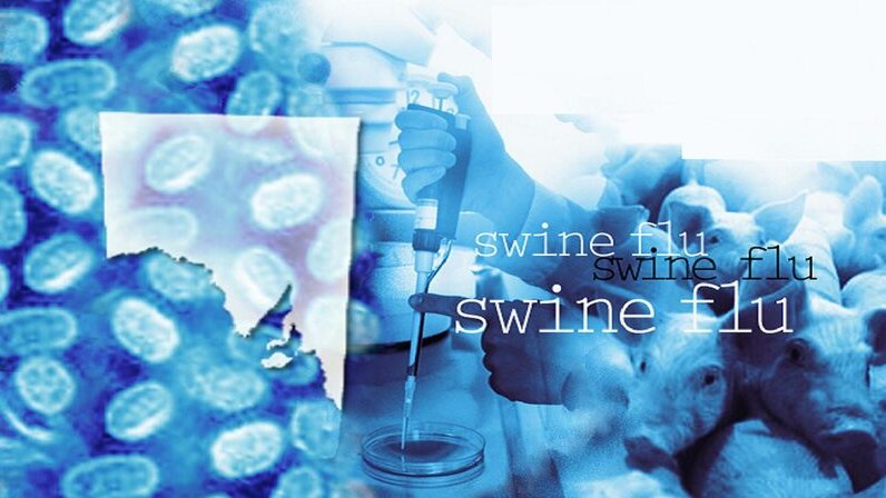 SA swine flu vaccine trial starting