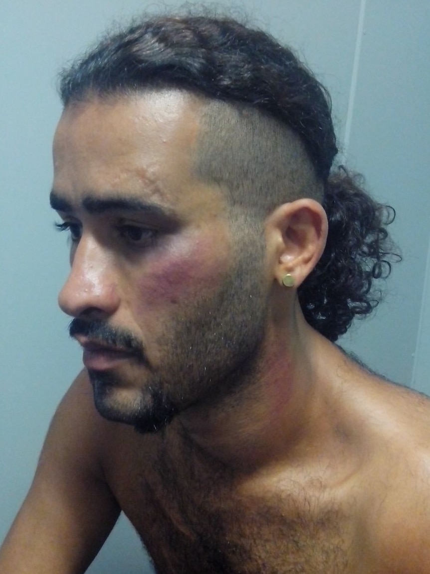 Manus Island refugee bashed