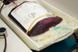 A blood bag on a scale