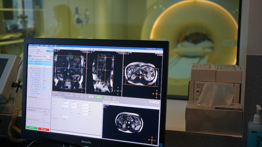 A computer screen in front of a glass window looking on to a CT machine shows scan imagery