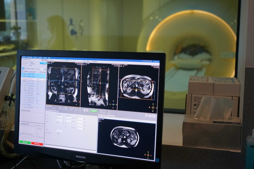 A computer screen in front of a glass window looking on to a CT machine shows scan imagery