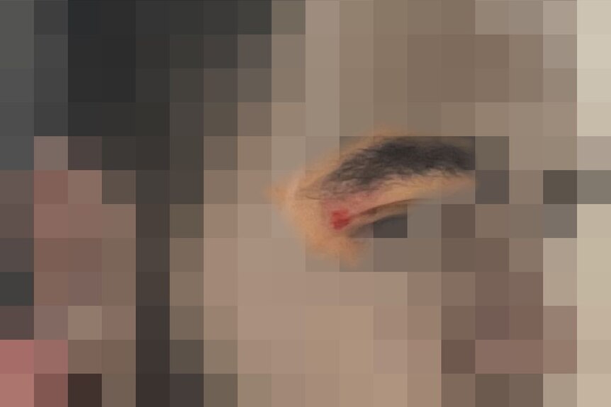 A blurred image of a man with cuts on his face