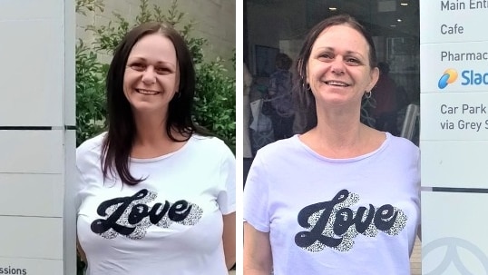 A composite image of a woman wearing a t-shirt that says "love" before and after breast reduction surgery.