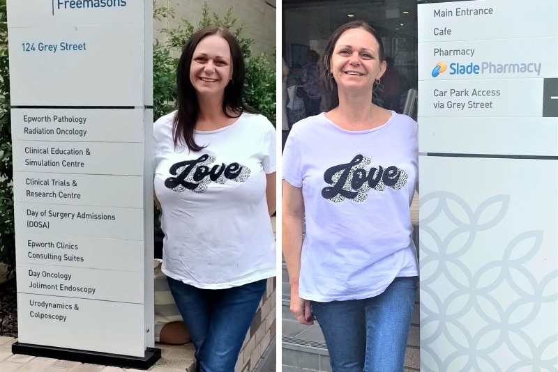 A composite image of a woman wearing a t-shirt that says "love" before and after breast reduction surgery.