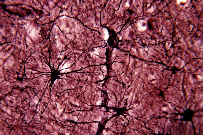 A purple-tinted microscope image of star-shaped cells with long branching tendrils.