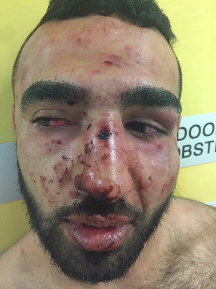 Omar El Baba, alleged bashing victim