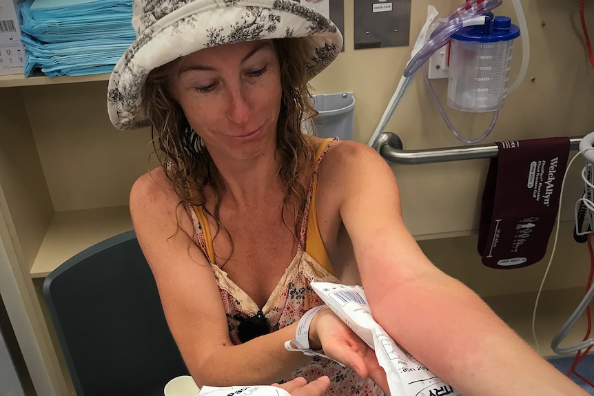 A girl in a sun hat nursing a rash on her left arm.