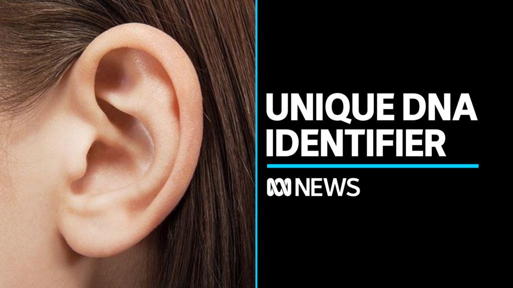 Ears found to be unique identifiers equivalent to fingerprints and DNA ...