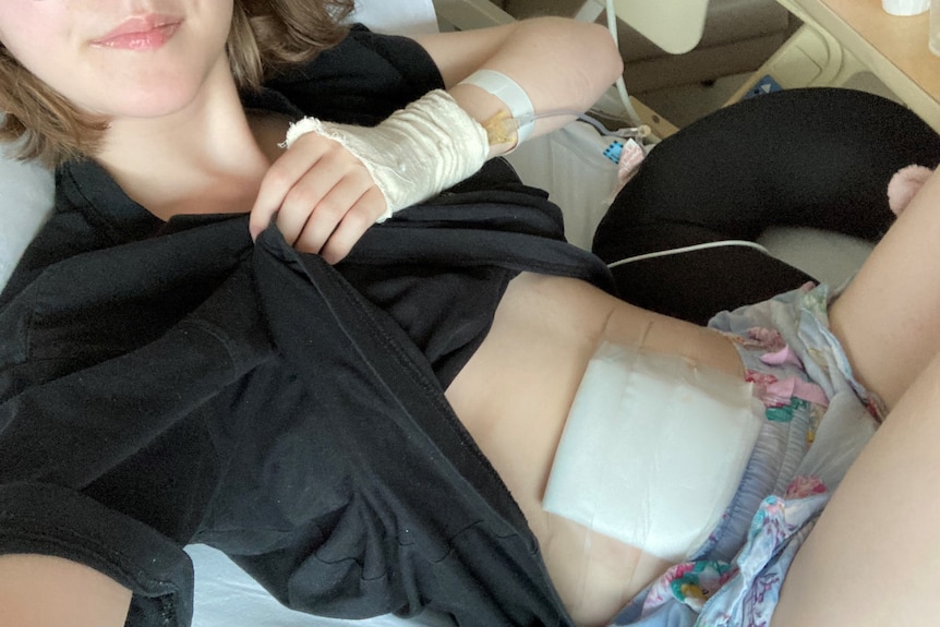 Amelia holding her t-shirt up to show a bandage on her abdomen