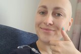 Bald young woman smiles with a thumbs up