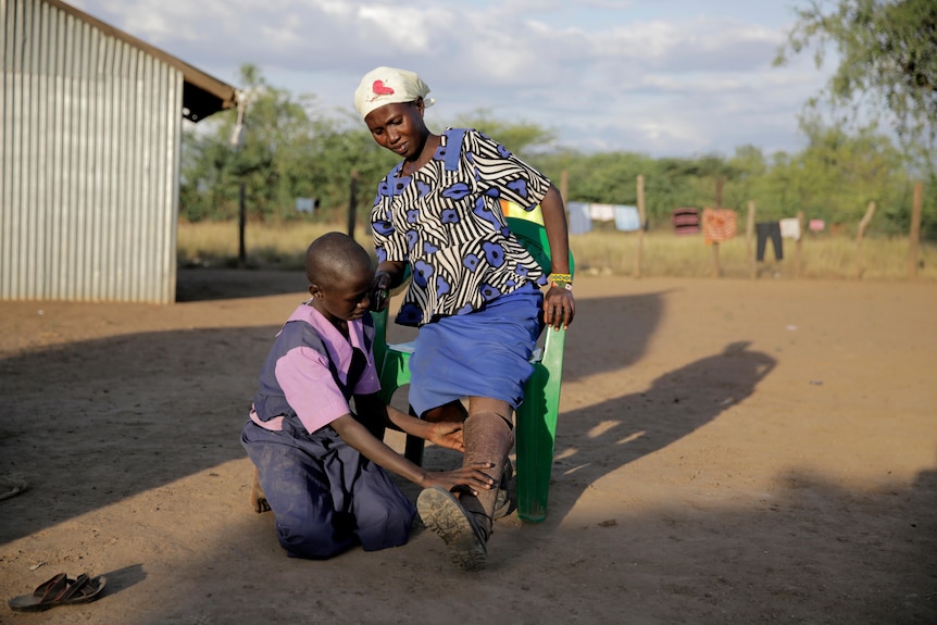 a young girl helps her mother to fix her artificial leg, mother sits on a plastic chair in the hot sun