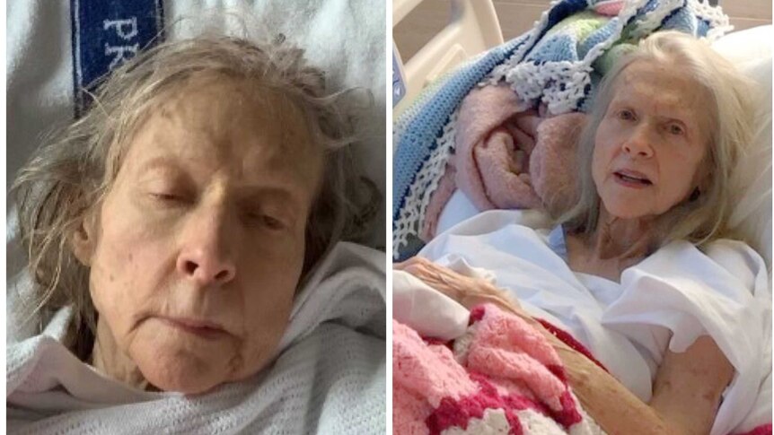 Collage of an elderly woman. Both photos show her laying in a hospital bed. She has long grey hair.