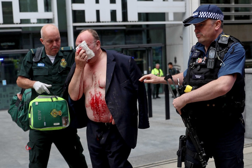 An injured man with blood on his stomach holds a bandage to his face while being lead by a policeman and a medic