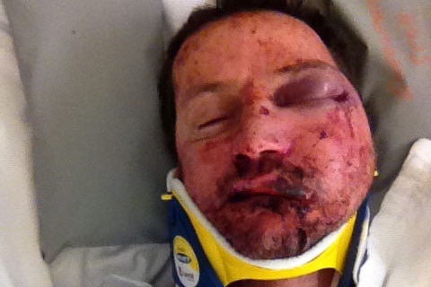 Raymond Ward who was bashed in Cloverdale