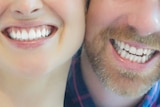 Couple smiling with white teeth.