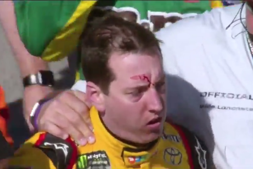 A bloodied Kyle Busch after his fight with Joey Logano