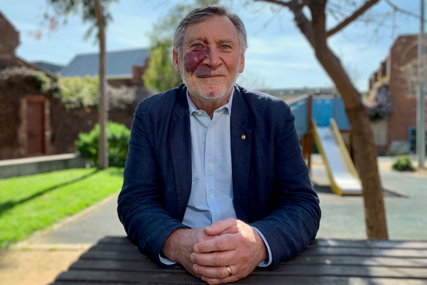 Microbiologist Paul Wood sitting at a table with clasped hands.