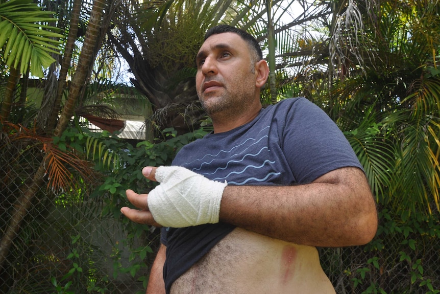Kais Al Selawi shows a scar on his abdomen by lifting up part of his shirt. His hand is also bandaged.