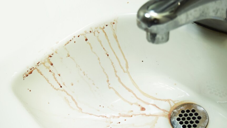 A bathroom sink is covered in specks of blood.