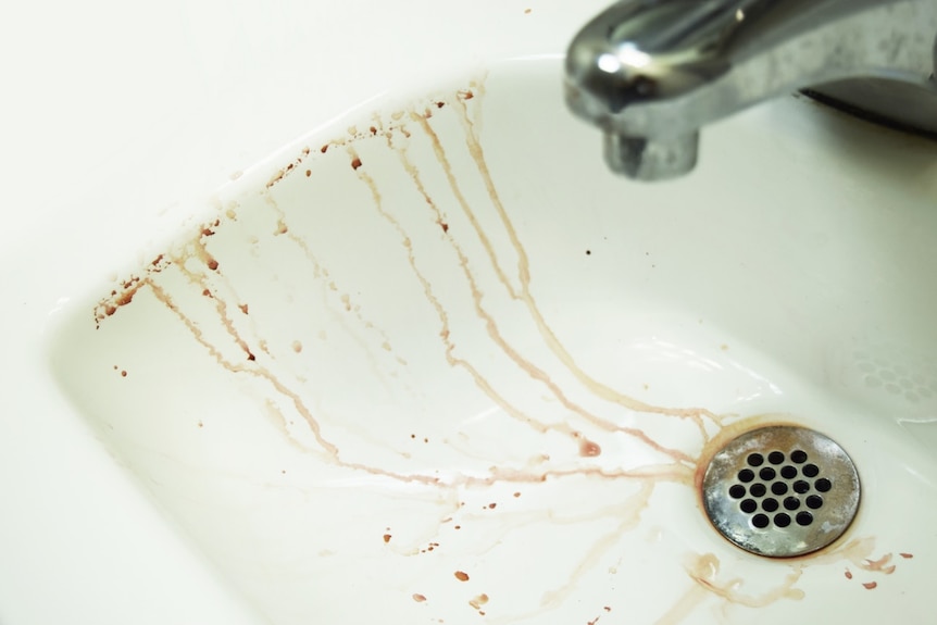 A bathroom sink is covered in specks of blood.