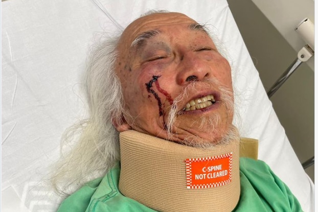 Man with blood on his cheek in neck brace lying in hospital