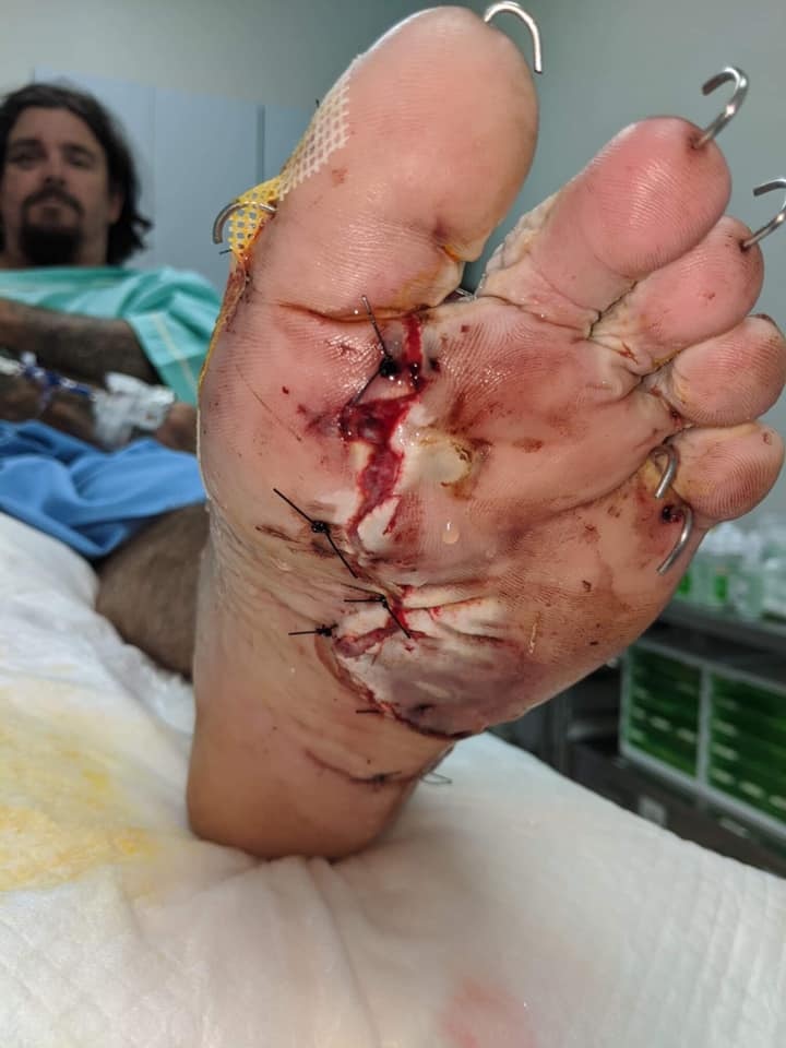 A foot with wires hanging out of it 