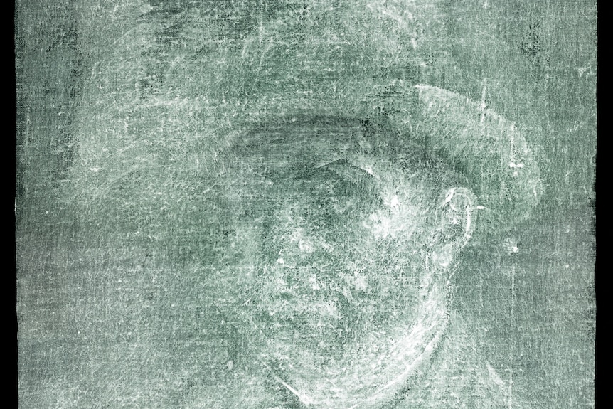 Vincent Van Gogh Photo X-Ray