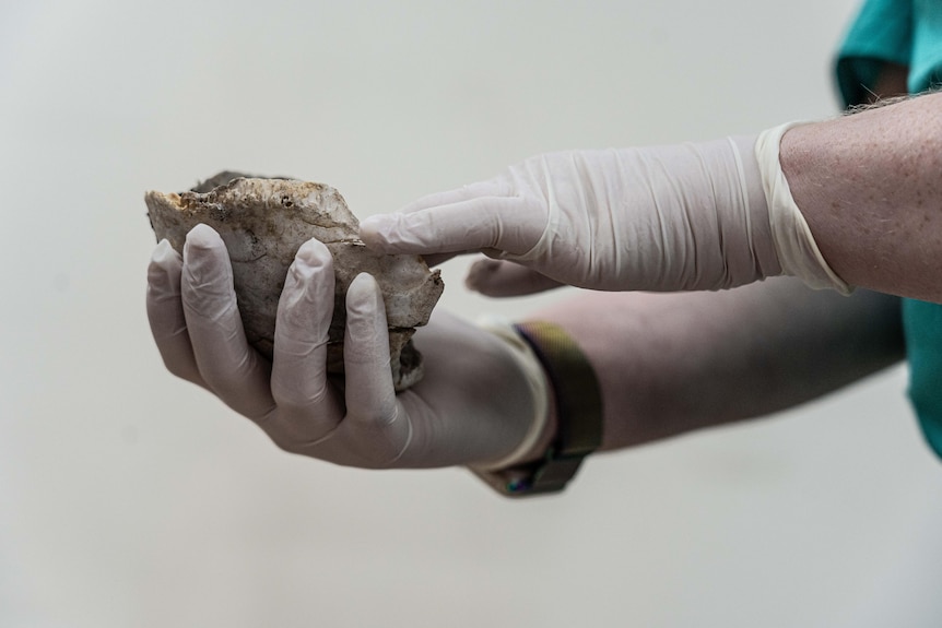 A close up of hands holding a badly burned human skull.