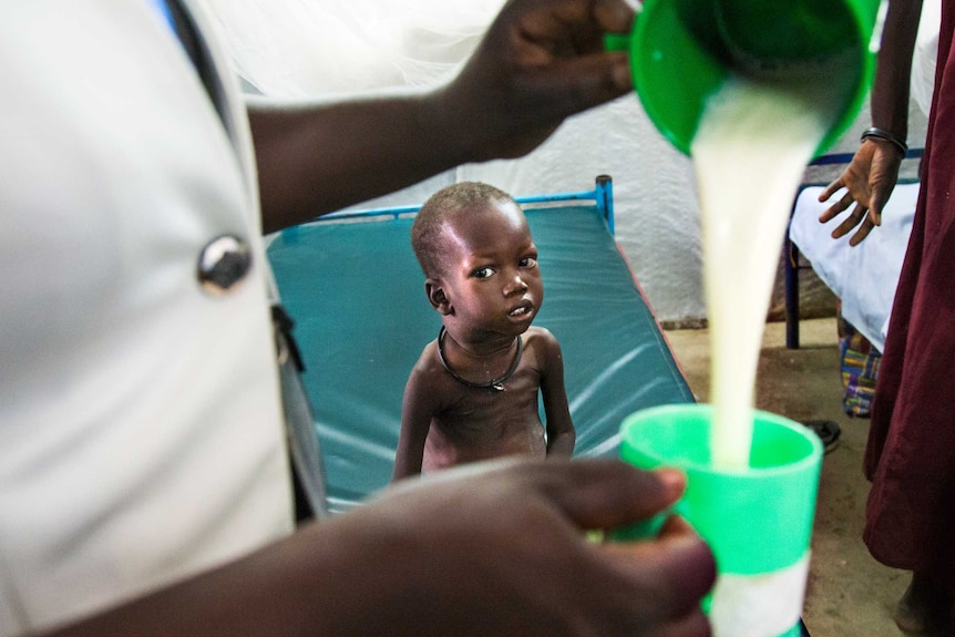 A malnourished child with visible ribs and a distended belly watches an aid worker pour milk. Juba, South Sudan.
