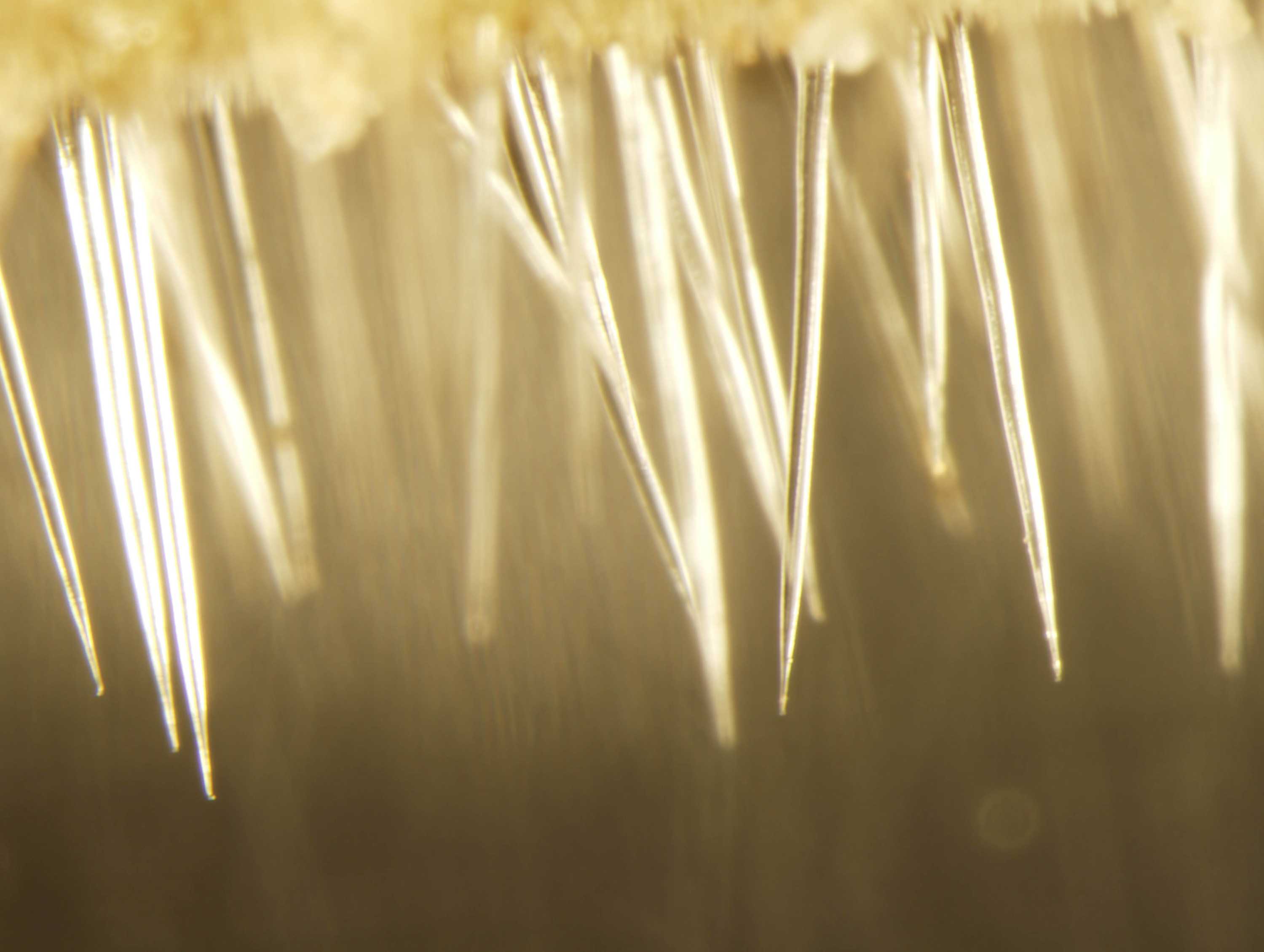An extreme magnification of stinging tree needles-like hairs called trichomes.
