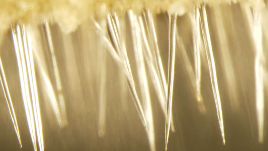 An extreme magnification of stinging tree needles-like hairs called trichomes.