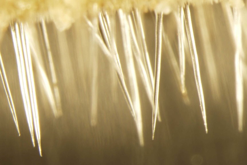 An extreme magnification of stinging tree needles-like hairs called trichomes.