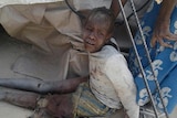 Child injured in mistaken bombing
