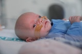 A small baby boy lies in an incubator with tubes in his nose.