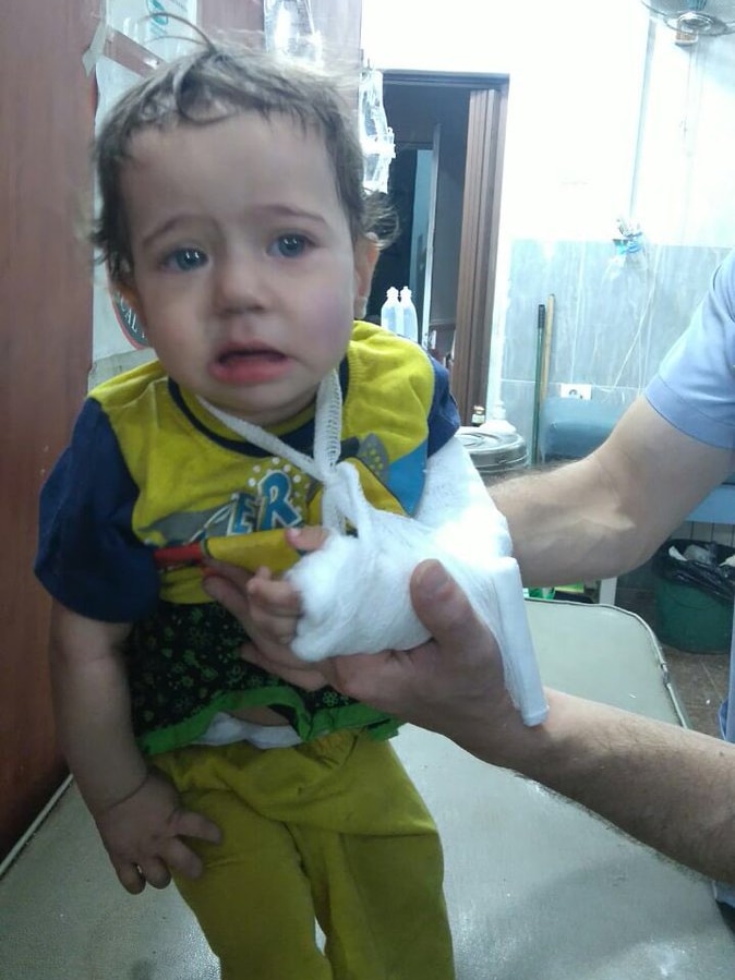 Child injured in Syria air strikes