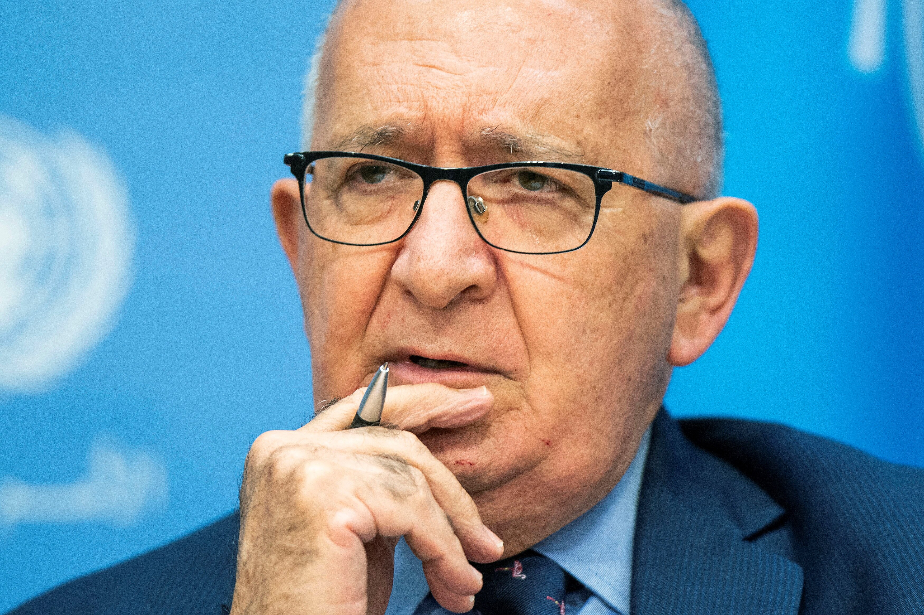 A man puts his hand to his chin and furrows his brow