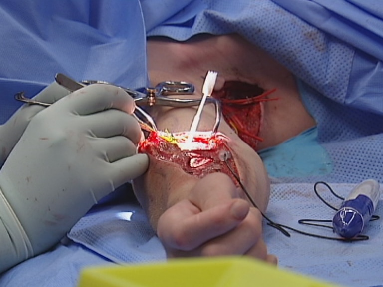 Jack Vawdrey in surgery