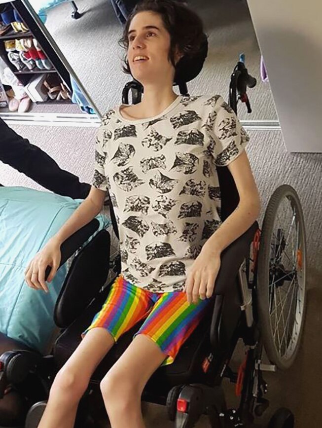 A woman with muscular dystrophy