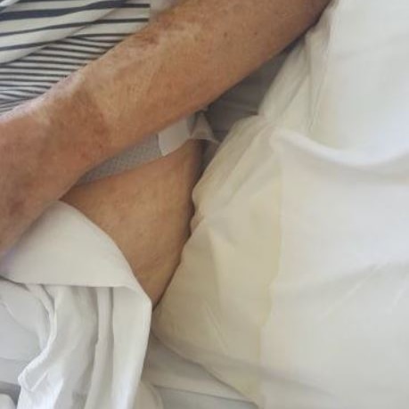 Apparently soiled sheets underneath the body of an elderly man.