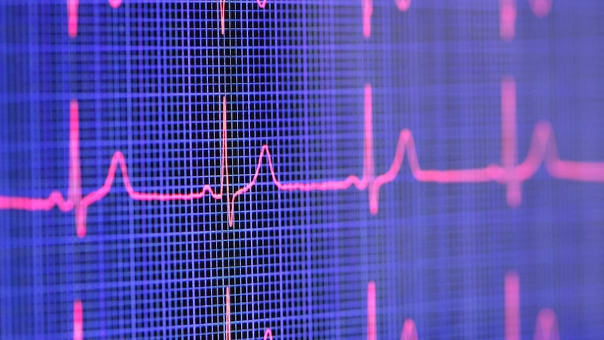 Electrocardiogram blips on a screen