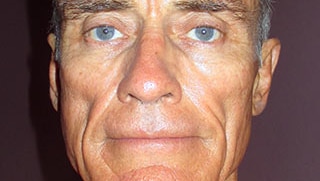A headshot shot with flash shows a man with white hair, blue eyes and an orange shirt.